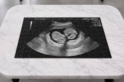 evermoireco gift box for pregnancy reveal or ultrasound announcemnt, perfect intimate surprise